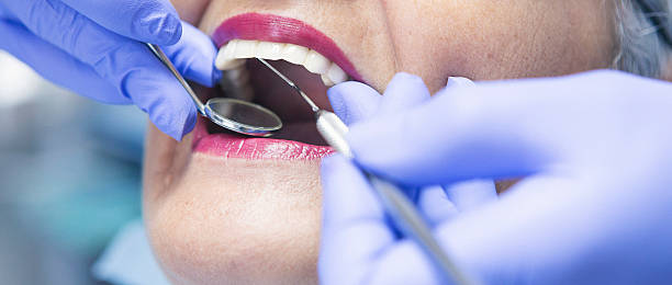 Best Emergency Dental Care for Broken or Chipped Teeth in Mims, FL